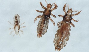 Five Tips to Protect Your Kids from Head Lice - RMN Kids